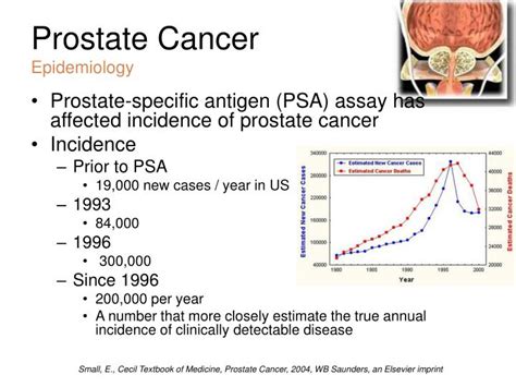 Ppt Prostate Cancer Powerpoint Presentation Id63763