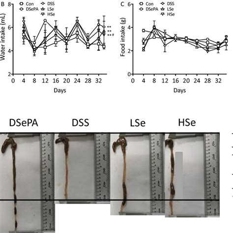 DSePA Ameliorated Symptom Severity In DSS Induced Colitis A Body