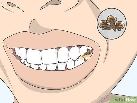 4 Ways to Use Clove Oil for Tooth Pain - wikiHow