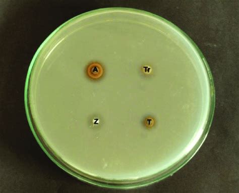 Zones Of Inhibition Seen After 24 Hours Download Scientific Diagram