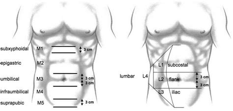 The Effects Of Preoperative Botulinum Toxin A Injection On Abdominal