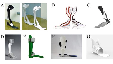 Examples Of D Printed Afo Orthoses A Carbon Fiber Afo Pallari