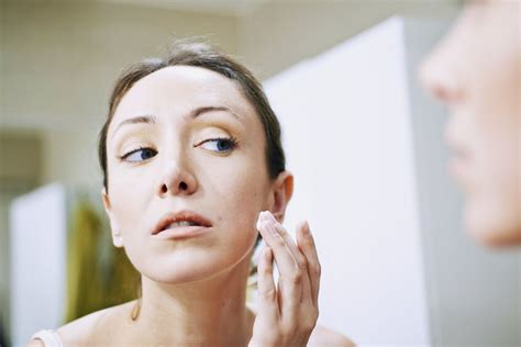 How To Prepare For A Dermatology Appointment For Acne