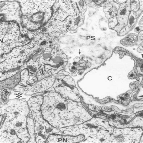 Transmission Electron Micrograph Of The Mouse Pineal Gland Documenting