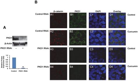 A Silencing Of PKD1 By PKD1 Specific SiRNA C4 2 Cells Were