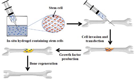 Bone Regeneration Using Alginate Based In Situ Hydrogel Containing Stem