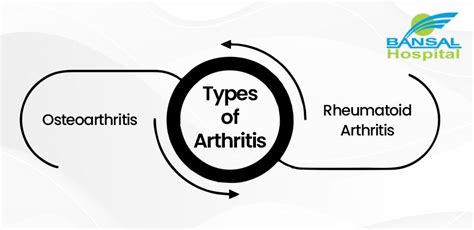 Rheumatoid Arthritis Causes Symptoms And Treatment Option