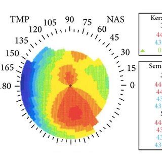 Pentacam Corneal Topography Before A Months After B And Year