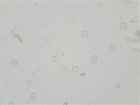 Blastocystis Hominis Stool