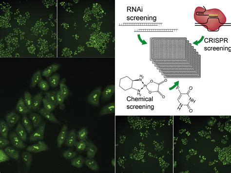 Ribosome synthesis in human cells – Institute of Biochemistry | ETH Zurich