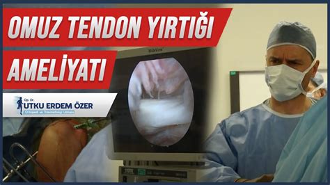 Omuz Tendon Yırtığı Ameliyatı Artroskopik Supraspinatus Tendon Tamiri