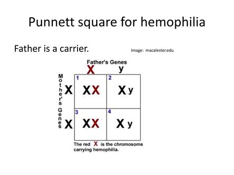 Hemophilia Punnett Square