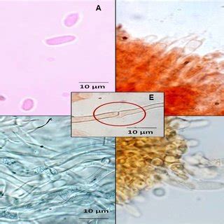 Light microscope photographs A. Basidiospores, B. Basidia, C. Pileus... | Download Scientific ...