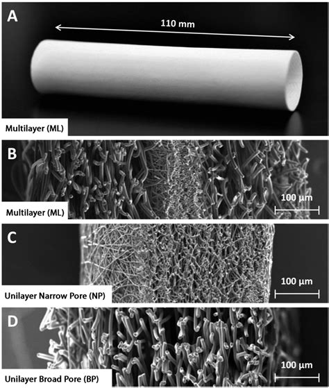 Structure And Ultrastructure Of Electrospun Pu Scaffolds A