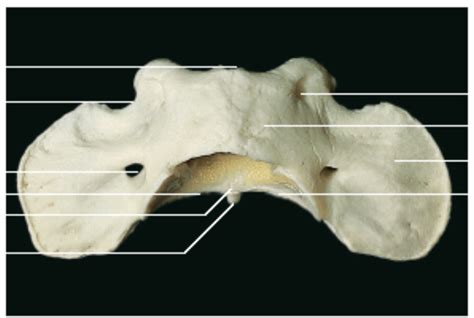 Atlante Di Cane Veduta Dorsale Diagram Quizlet