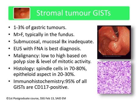 Management Of Gastric Polyps Ppt