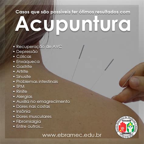 Pin Em Acupuntura Medicina Chinesa