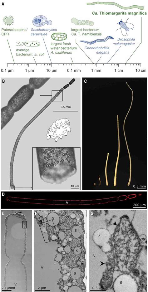 Questo è il batterio più grande del mondo ed è visibile ad occhio nudo