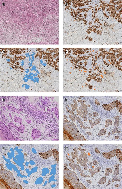 Histopathology Using Hematoxylin And Eosin Hande Stains A E And Download Scientific Diagram