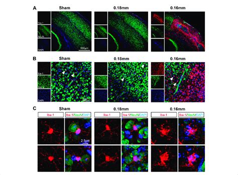 Microglial Activation Is Accompanied By Neuronal Loss In The Cerebral