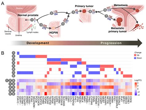 Cancers Free Full Text The Transcriptomic Landscape Of Prostate