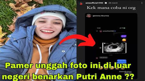 Gegerkan Publik Putri Anne Unggah Foto Ini Di IGS Nya Benarkah PA