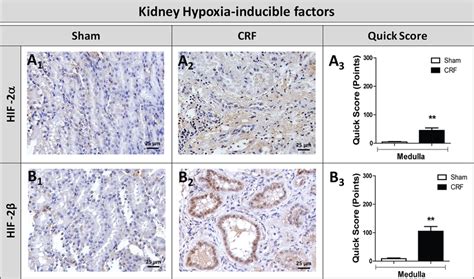 Hif And Hif Immunohistochemical Expression In The Kidney Kidney