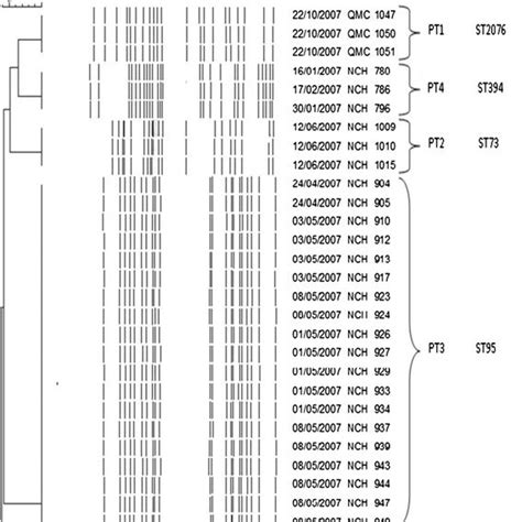 Pulsed Field Gel Electrophoresis Of Thirty E Coli Strains Isolated Download Scientific Diagram