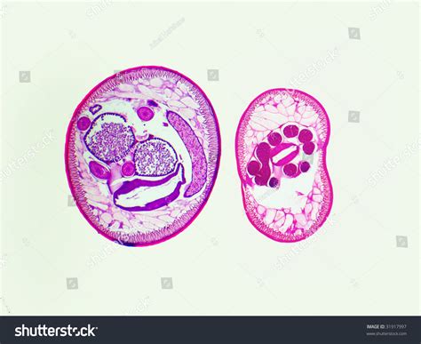 Ascaris Lumbricoides Male And Female Cross Section