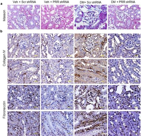 Masson Staining And Immunostaining Of Collagen IV And Fibronectin In