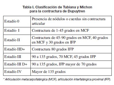 Tratamiento No Quir Rgico De La Contractura De Dupuytren Con Colagenasa