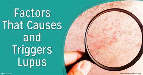 What Causes Lupus: Factors That Trigger This Condition