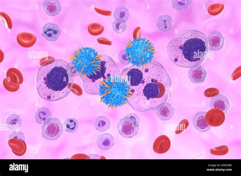 Car T Cell Therapy In Multiple Myeloma Mm Isometric View 3d