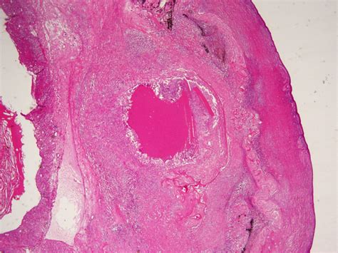 Moran Core Cellular Histopathology