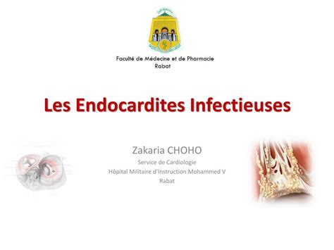 Pdf Endocardite Infectieuse Pdf Dokumen Tips