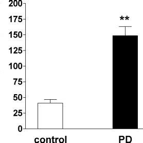 Cerebrospinal Fluid CSF Levels Of N OFQ Are Elevated In Parkinson S