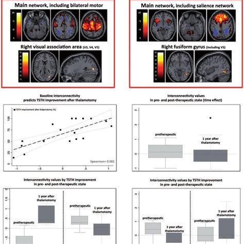 Main Findings From Our Recent Resting State Functional Mri Study