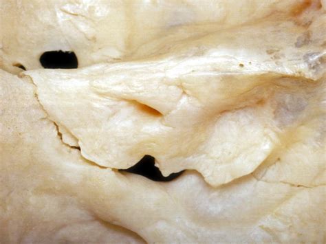 Posterior Surface of Right Petrous Bone | Neuroanatomy | The ...