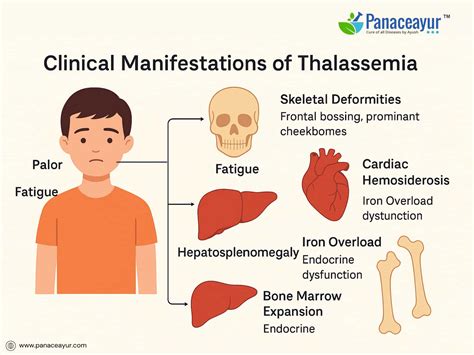 thalassemia treatment symptoms   natural approach