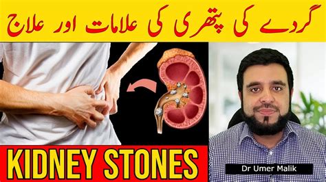 Gurde Mein Pathri Ki Alamat Gurday Ka Dard Gurde Me Stone Kidney