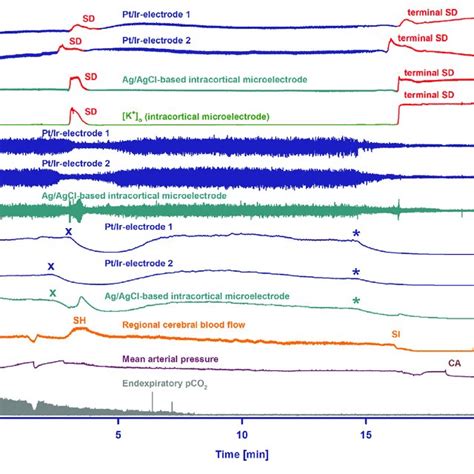 Comparison Of Normoxic Sd With Hypoxic Sd Preceded By Non Spreading