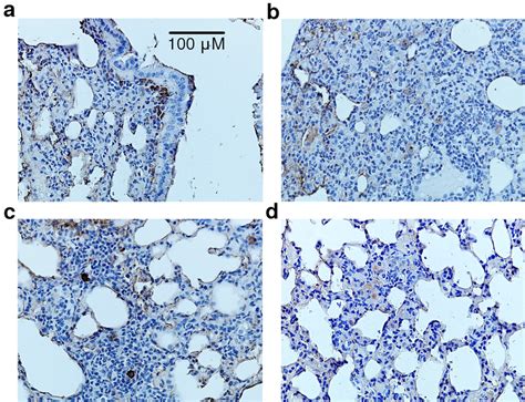 Sections Of Lung Tissue CD68 Immunostaining Nuclei Stained With