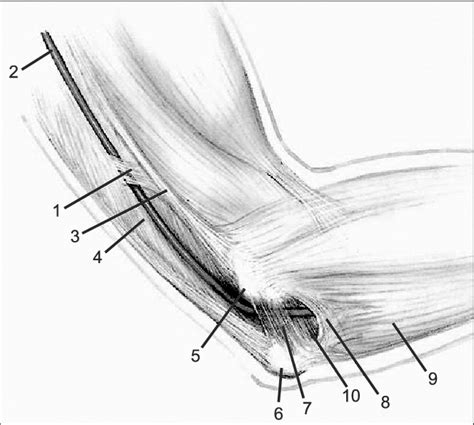 Ulnar Nerve Entrapment Elbow