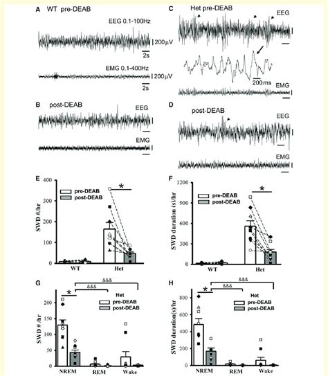 Suppression of SWO-induced homeostatic synaptic potentiation by DEAB ... 