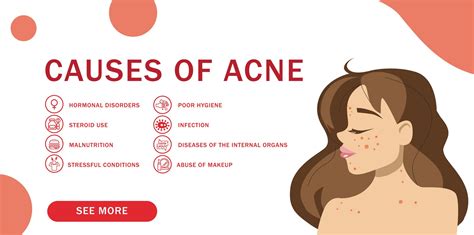 How to Balance Hormones to Reduce Hormonal Acne - Natural Bio Health