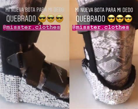 Kel Calderon Es La Moda Tras Su Fractura Luce Una Bota Ortop Dica