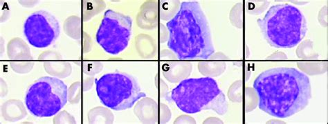 Examples of the different lymphocytes. Lymphocytes classified as: (A ...