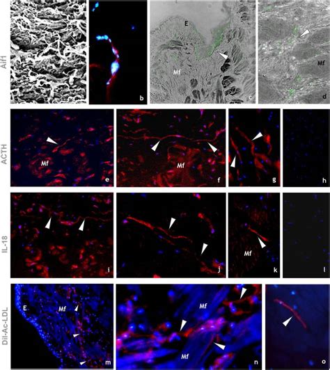 Immunocytochemical Characterization Of Hmtcs A D Hmtcs Recruited