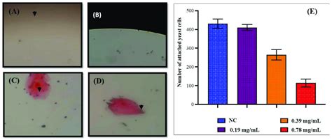 Adherence of C. auris MRL6057 to buccal epithelial cells. (A) Negative ... 