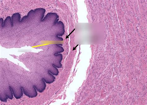 Esophagus Diagram | Quizlet